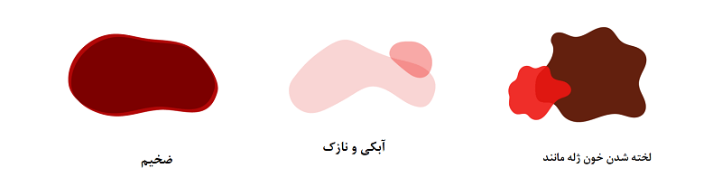 دلایل اصلی لخته شدن خون پریود چیست