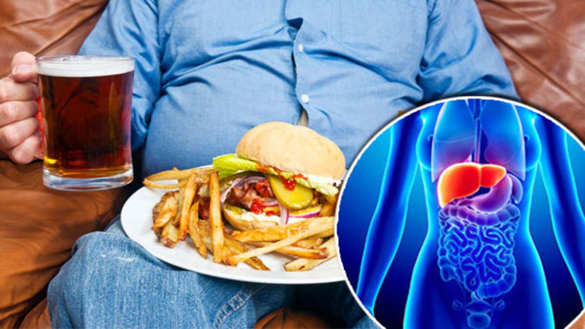 غذای مناسب بیماران کبد چرب تغذیه مناسب برای بیماران کبد چرب