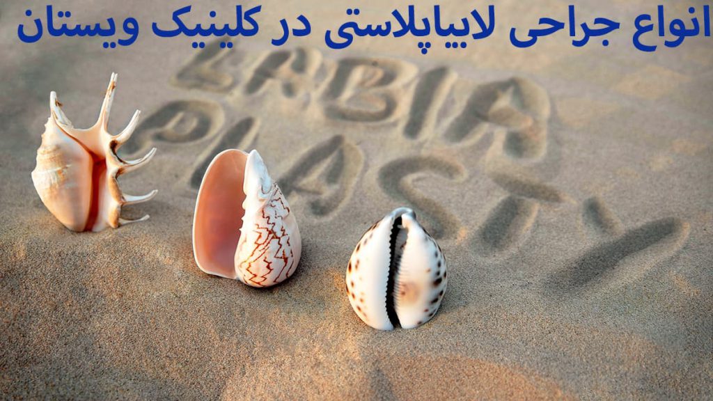 نوشته ای درخصوص لابیاپلاستی به همراه چند صدف نمایش داده می شود