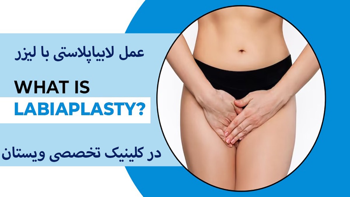 یک خانم و نوشته ای در خصوص لابیاپلاستی نمایش داده می شود