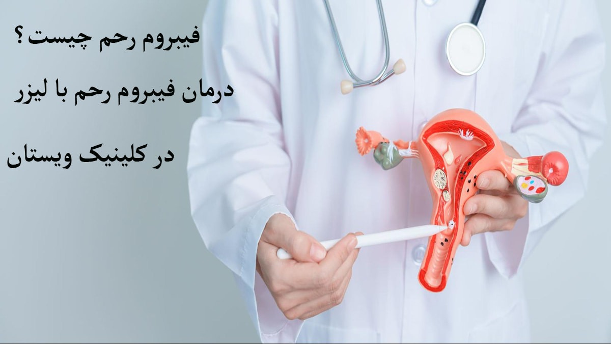 پزشکی در حال نشان دادن فیبروم رحم