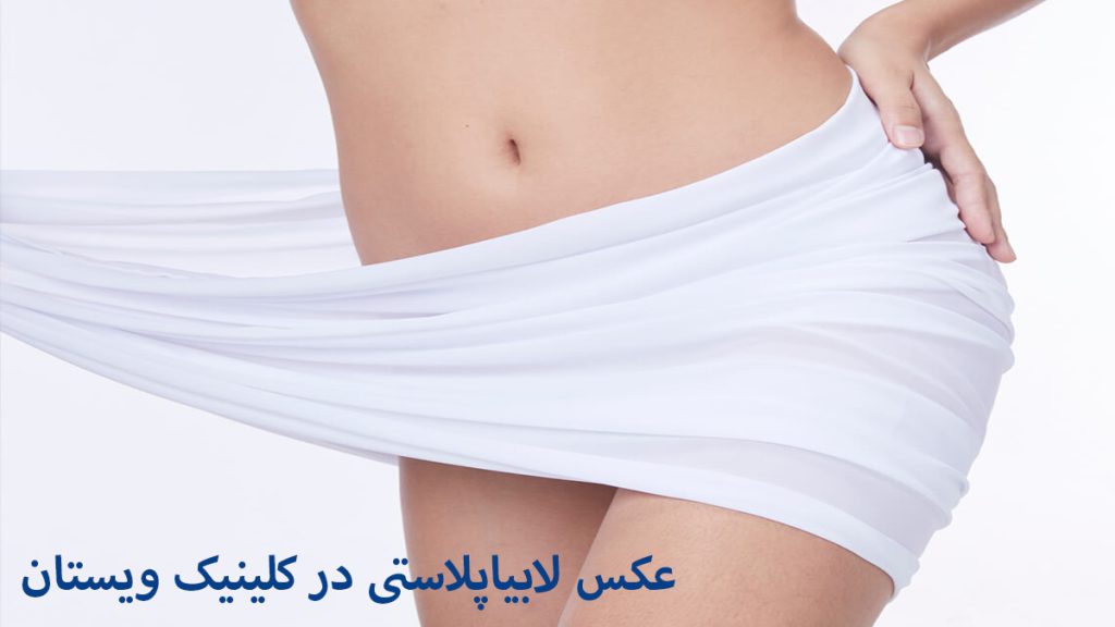 یک خانم و نوشته ای در خصوص عکس لابیاپلاستی نشان داده می شود