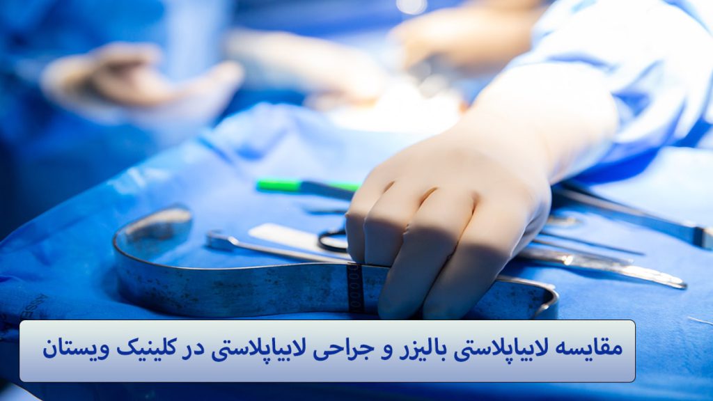 جراحی لابیاپلاستی