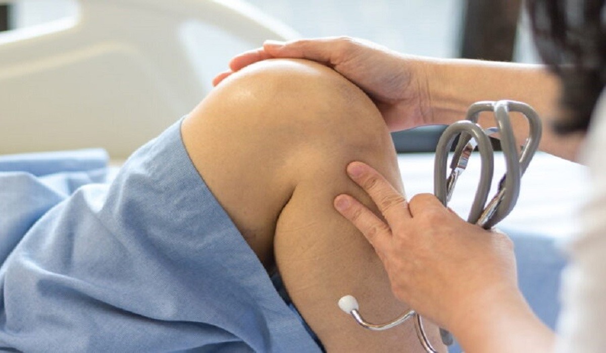 مراقبت بعد PRP مراقبتهای بعد پی آر پی
