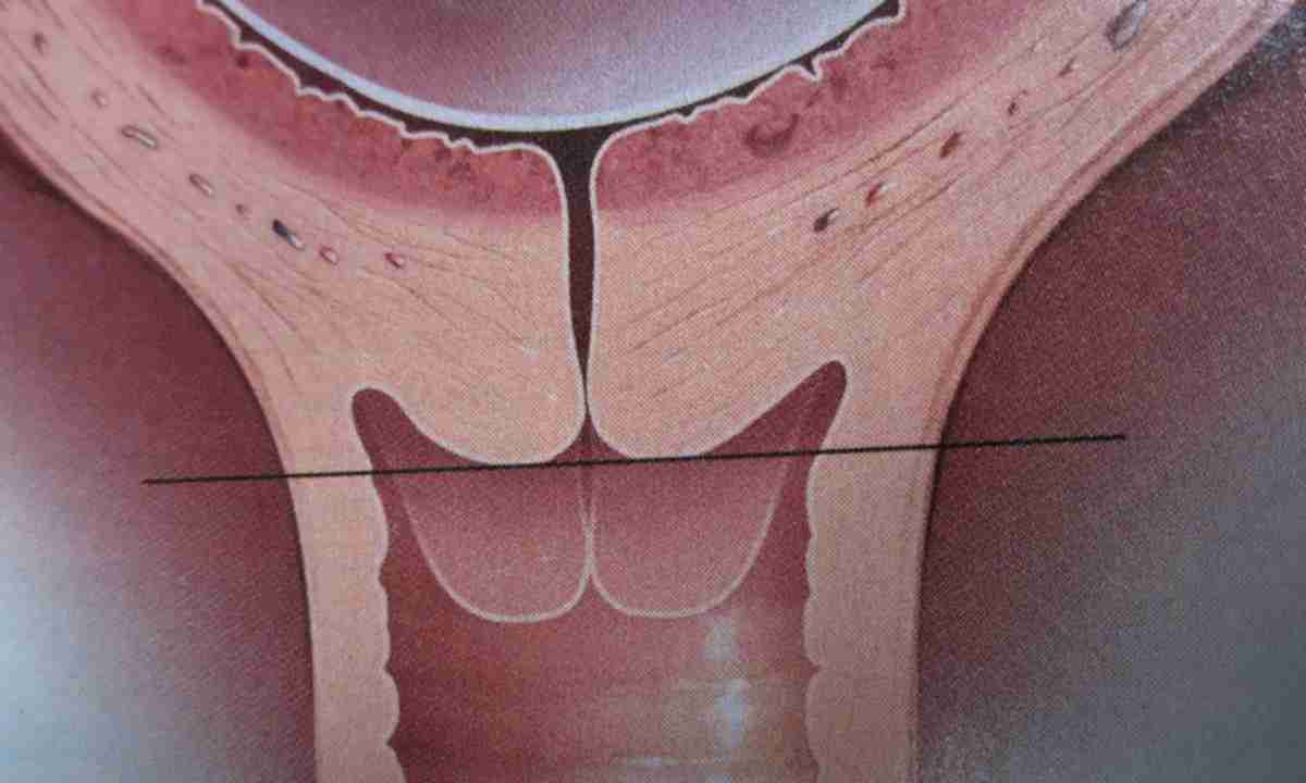 دلایل پارگی بکارت + علائم پاره شدن بکارت