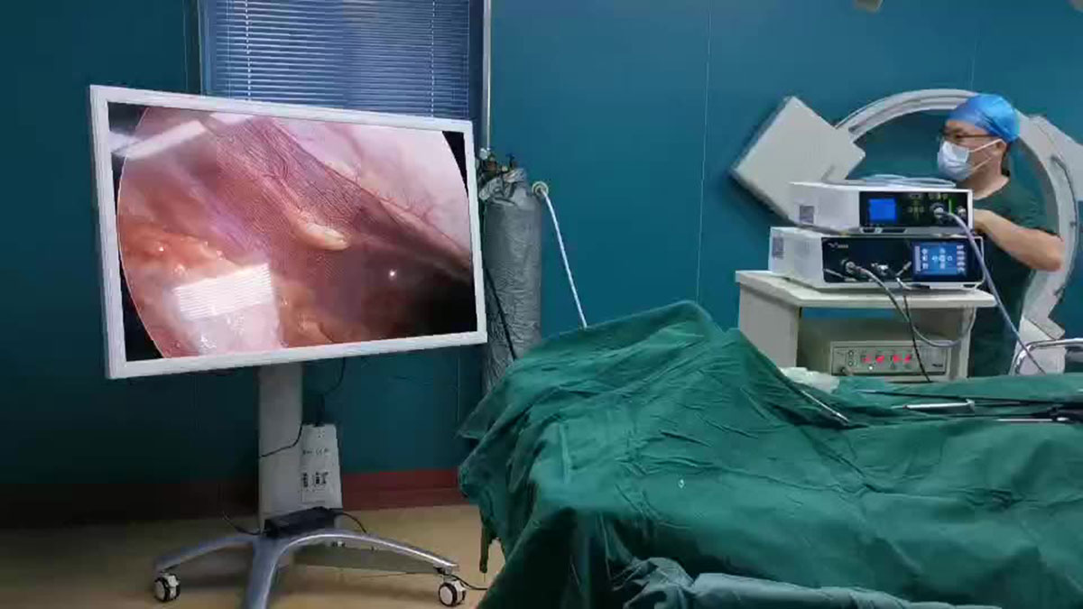 مرکز کولونوسکوپی تهران بهتربن مرکز کولونوسکوپی مرزداران