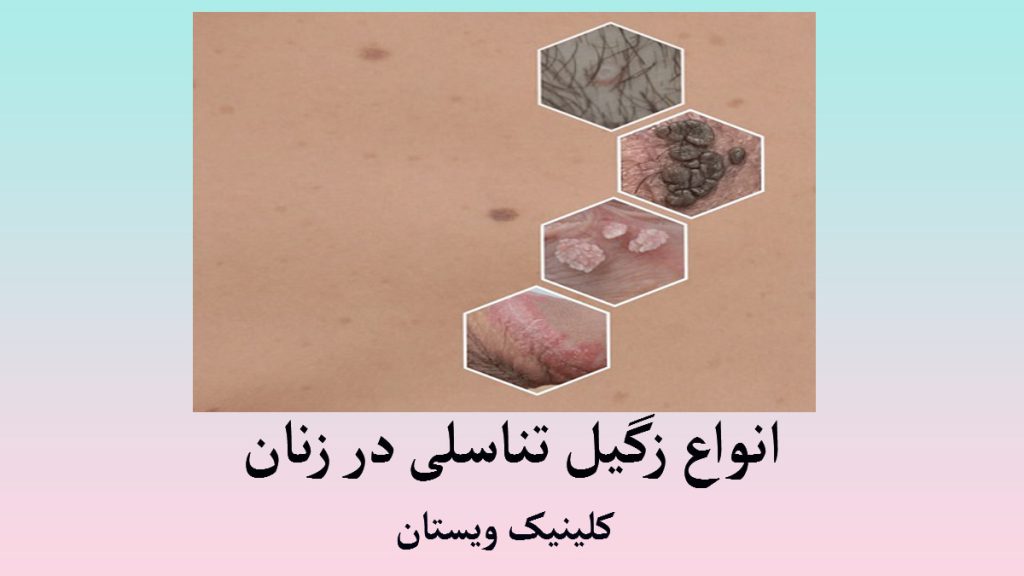 چند زگیل تناسلی نمایش داده می شود