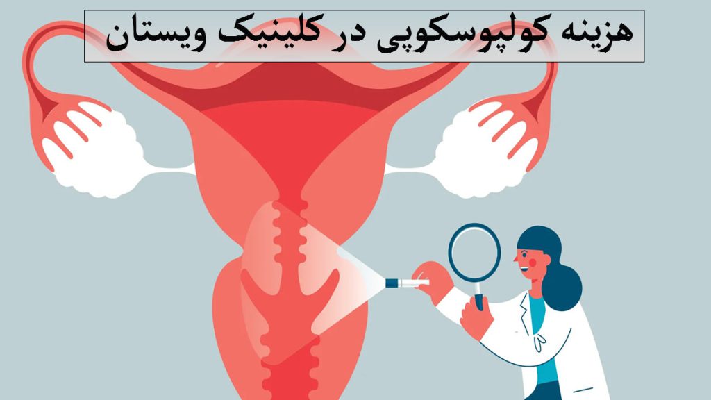 هزینه کولپوسکوپی یک پزشک که در حال بررسی رحم است-تصویر انیمیشنی است