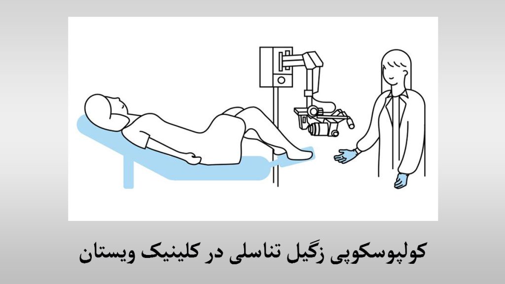 نحوه انجام کولپوسکوپی با یک تصویر انیمیشنی