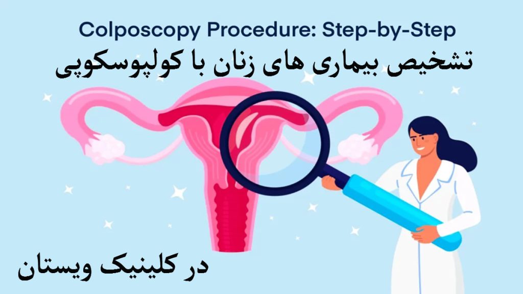 تشخیص بیماری های زنان با کولپوسکوپی تصویری انیمیشنی از یک پزشک که یک ذره بین در دست دارد برای توضیح بیماری های زنان
