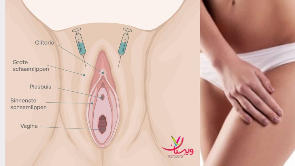 رضایت جنسی تزریق ژل به واژن