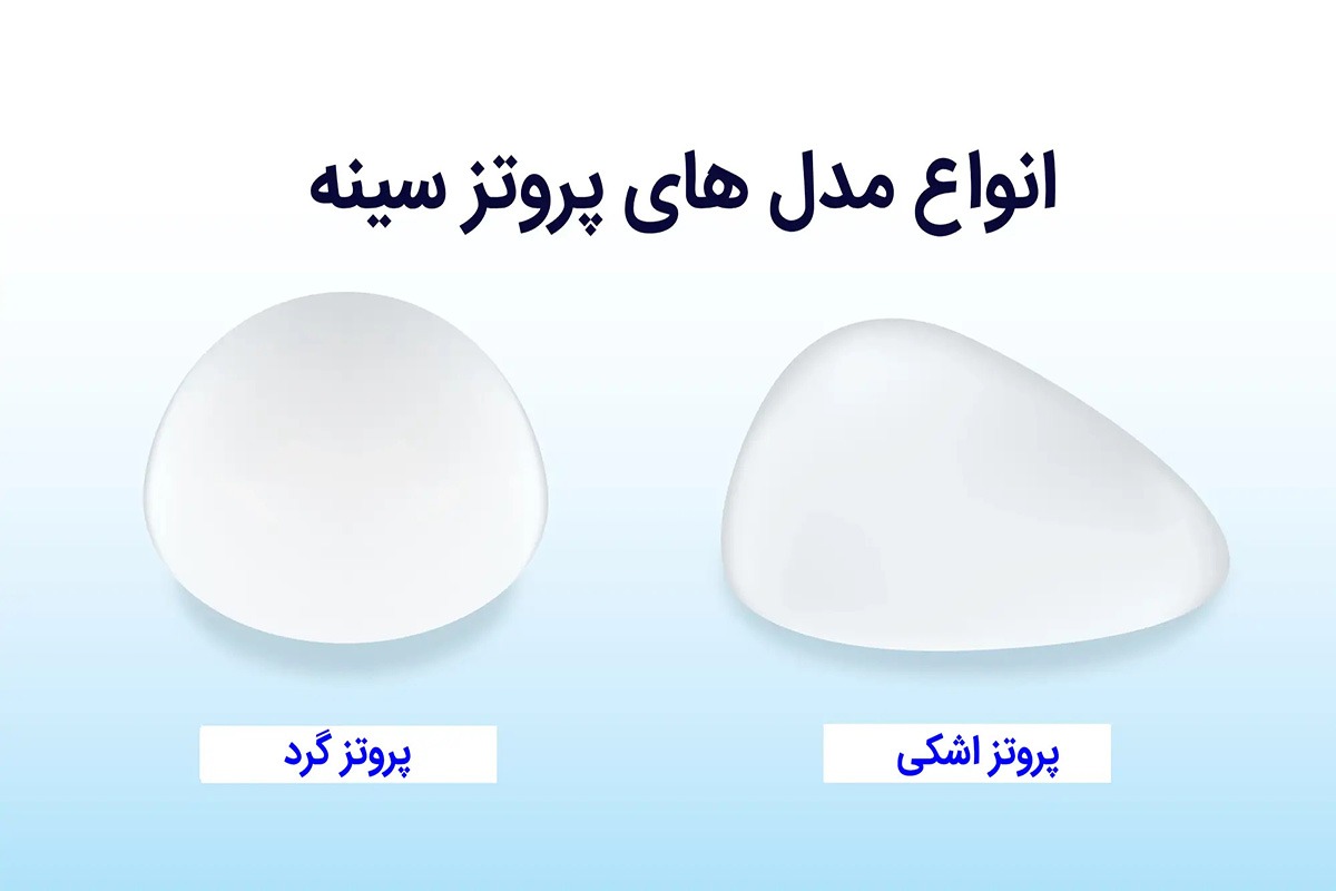 پروتز سینه اشکی + فیلم و عکس