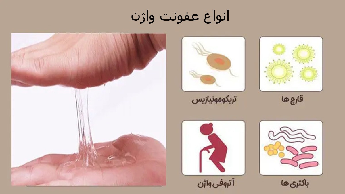عکس عفونت واژن انواع عفونت واژن