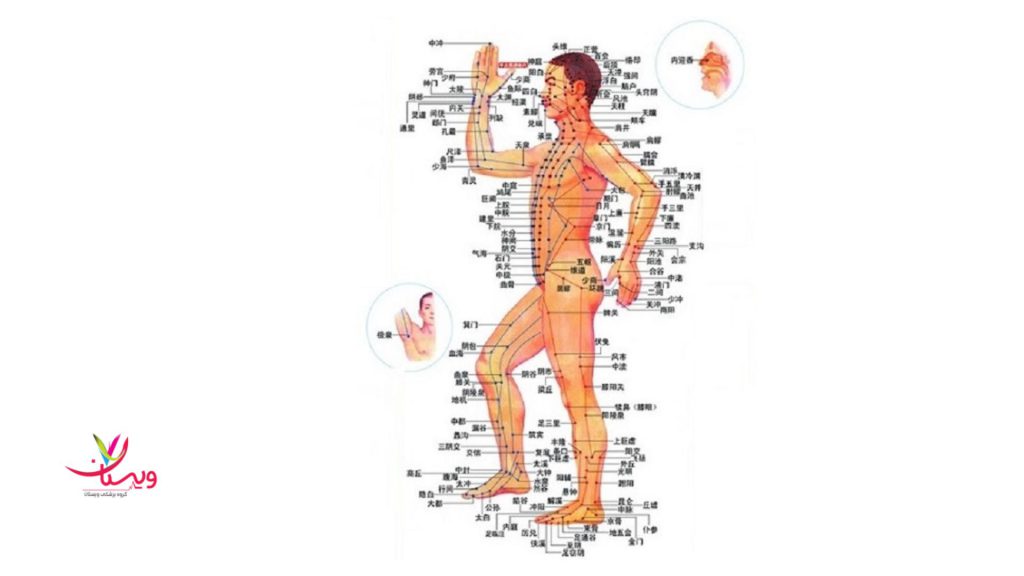 نقشه نقاط طب سوزنی در بدن