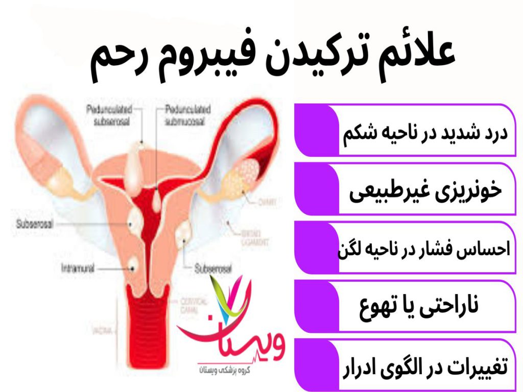احساس فشار در ناحیه لگن علائم ترکیدن فیبروم رحم
