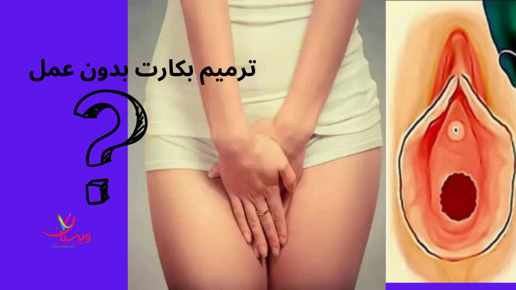 پرده بکارت آیا ترميم بكارت بدون عمل امکانپذیر هست