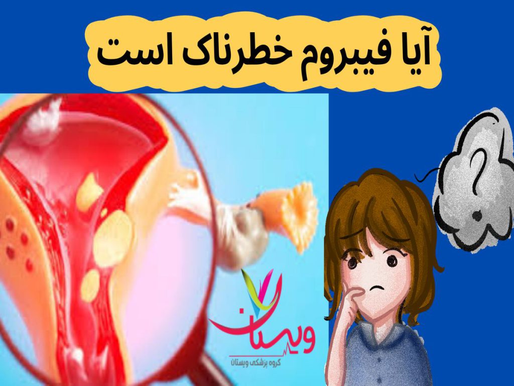 خونریزیهای غیرطبیعی آیا فیبروم خطرناک است
