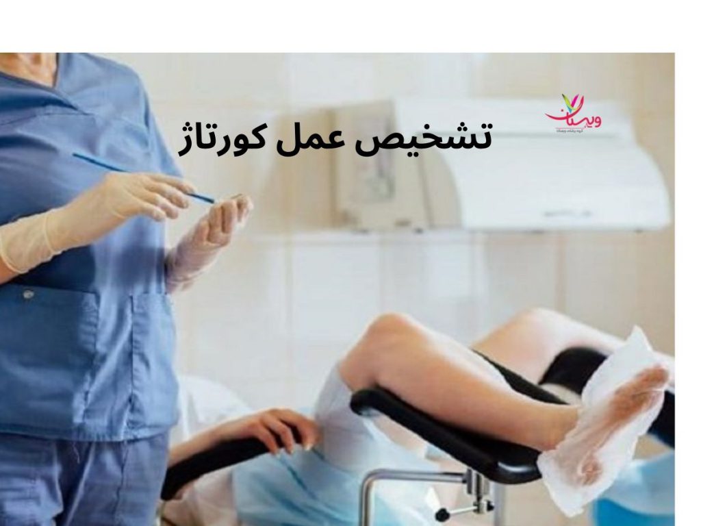 کورتاژ چیست و چگونه انجام میشود