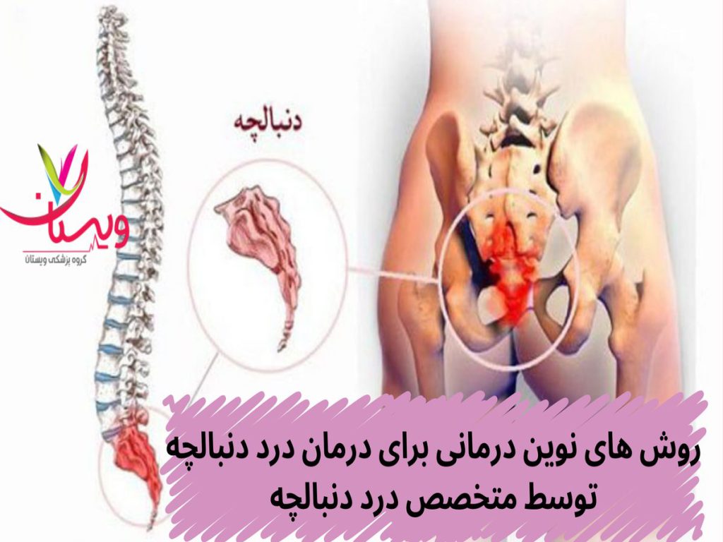 روش های نوین درمانی برای درمان درد دنبالچه توسط متخصص درد دنبالچه