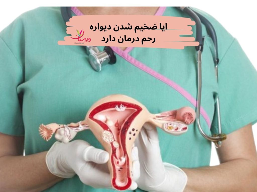 درمان ضخیم شدن دیواره رحم ایا ضخیم شدن دیواره رحم درمان دارد