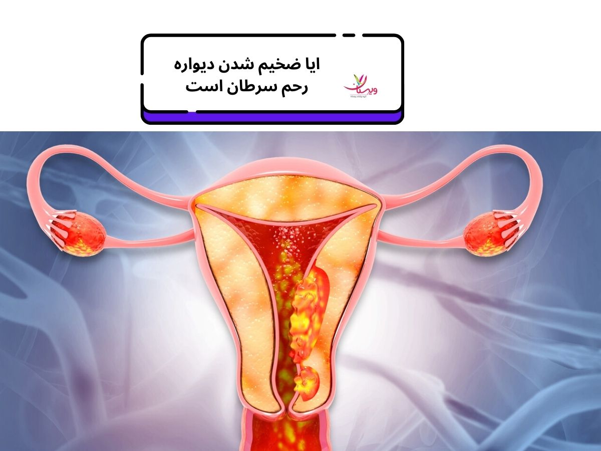 ایا ضخیم شدن دیواره رحم سرطان است