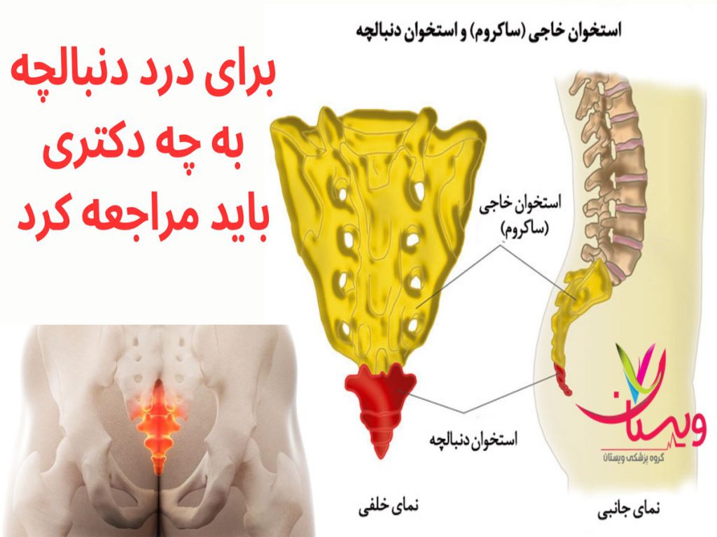 برای درد دنبالچه به چه دکتری باید مراجعه کرد