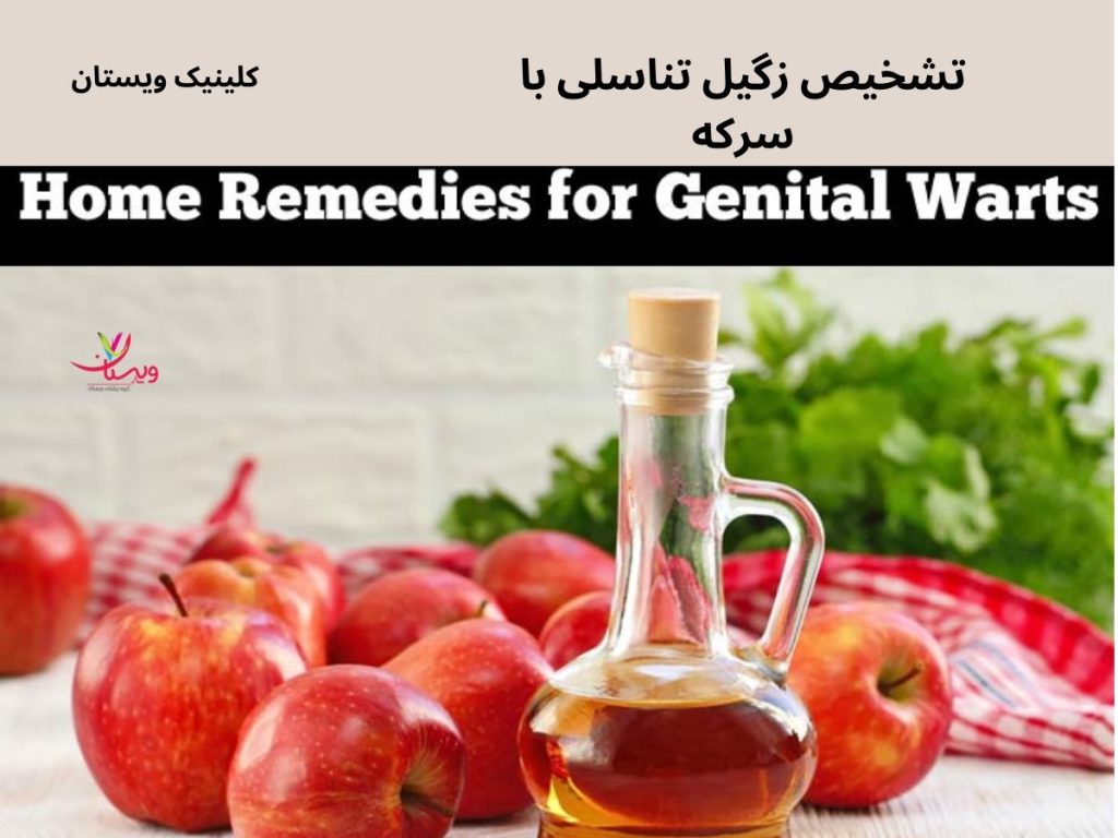 ضایعات پوستی کوچک تشخیص زگیل تناسلی با سرکه