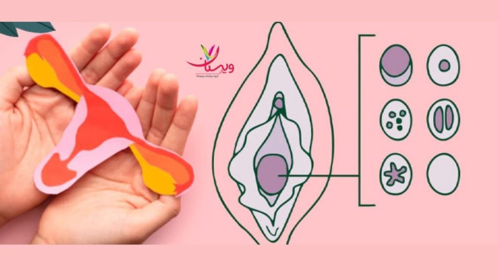 پرده بکارت یا هایمن hymen چیست