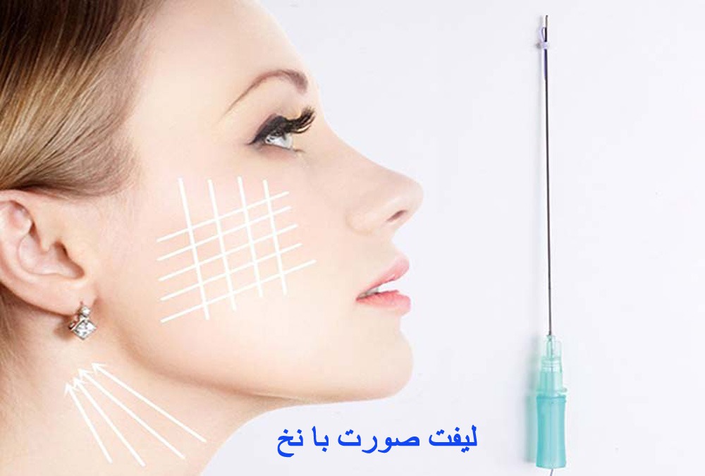 جوانسازی صورت با نخ لیفت صورت با نخ