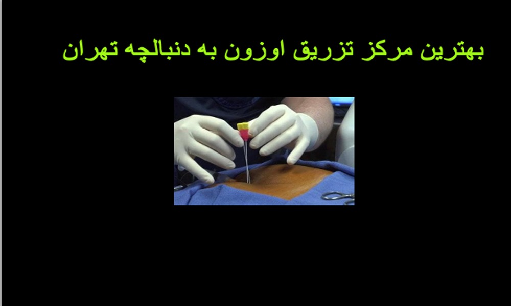 تزریق اوزون به دنبالچه + نظرات مردم درمورد اوزون تراپی چیست؟