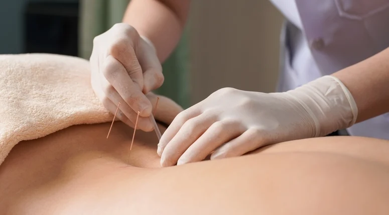 بهترین متخصص طب سوزنی در غرب تهران ستارخان
