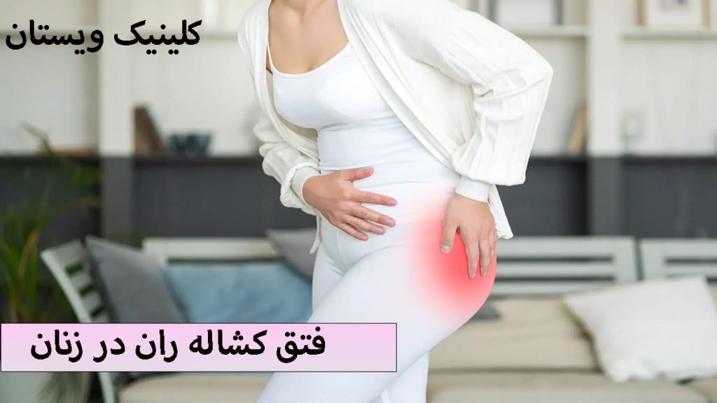 یک خانم با لباس سفید و با درد در قسمت لگن