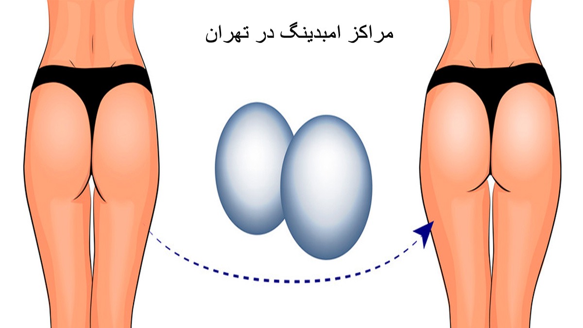 مرکز امبدینگ مرکز امبدینگ در تهران