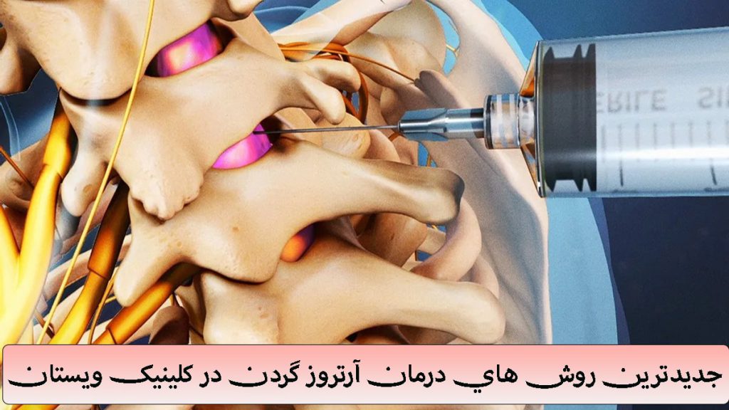 درمان آرتروز گردن با پی آر پی تزریق به مهره های گردن