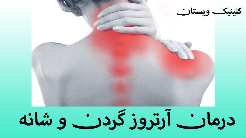 درمان آرتروز گردن یک خانم که درد شانه و گردن او با رنگ قرمز نشان داده شده است
