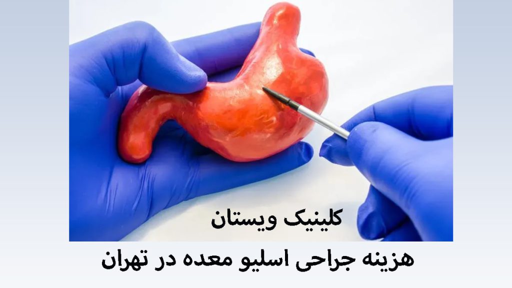 یک پزشک در حال نمایش مولاژ معده