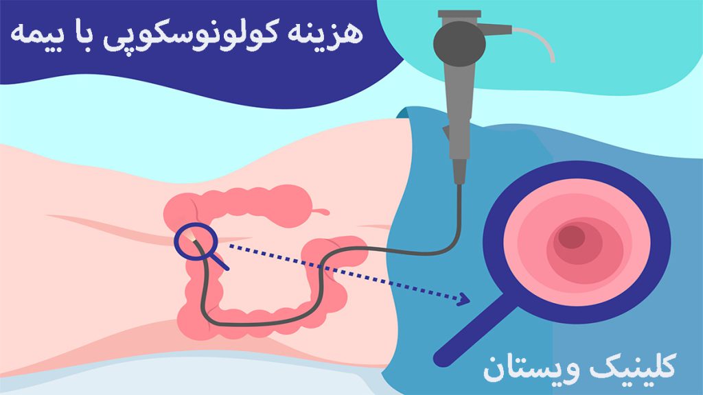 یک دستگاه کولونوسکوپی در داخل روده یک شخص