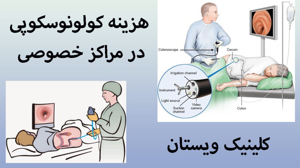 دو تصویر انیمیشنی از انجام کولونوسکوپی- نوشته با عنوان هزینه کولونوسکوپی