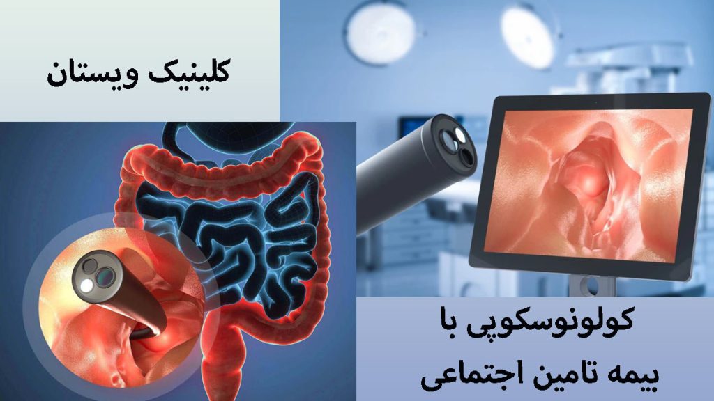 دو تصویر از انجام کولونوسکوپی