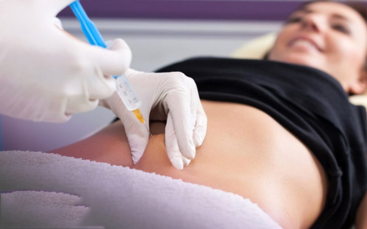 مزوتراپی لاغری چیست؟ فیلم مزوتراپی لاغری شکم