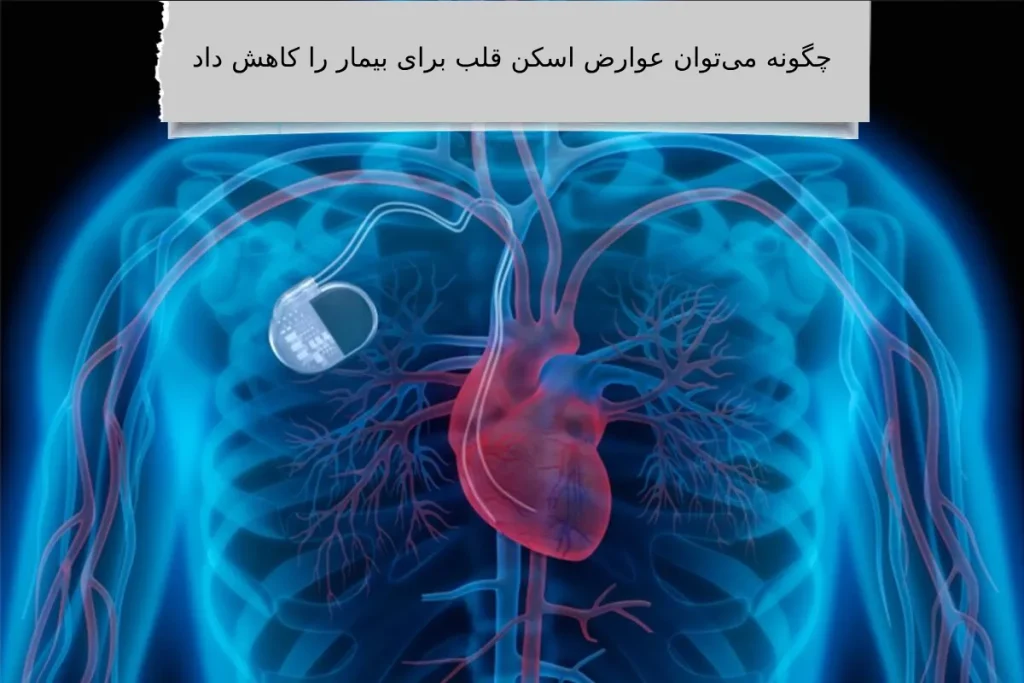 چگونه میتوان عوارض اسکن قلب برای بیمار را کاهش داد اسکن هستهای قلب