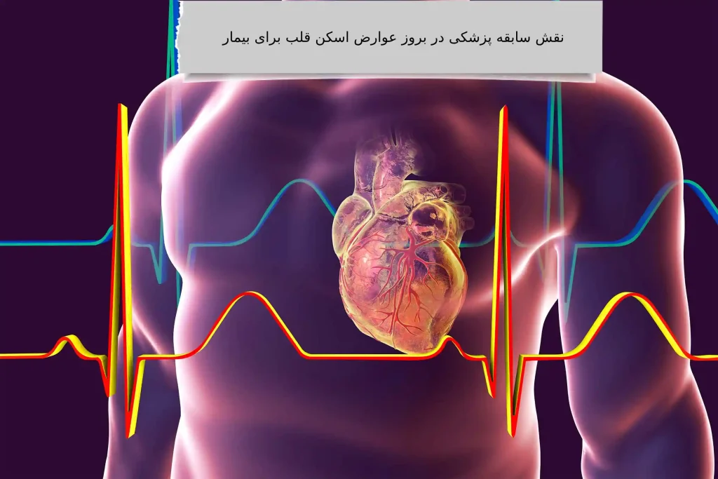 نقش سابقه پزشکی در بروز عوارض اسکن قلب برای بیمار اسکن هستهای قلب