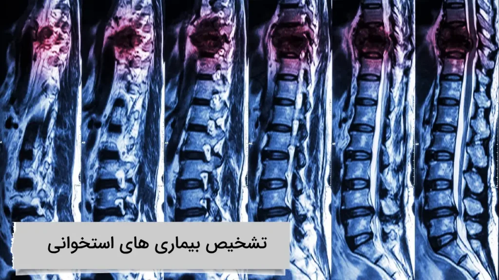 تشخیص بیماری های استخوانی تشخیص بیماری های استخوانی در بهترین مرکز اسکن هسته ای در تهران