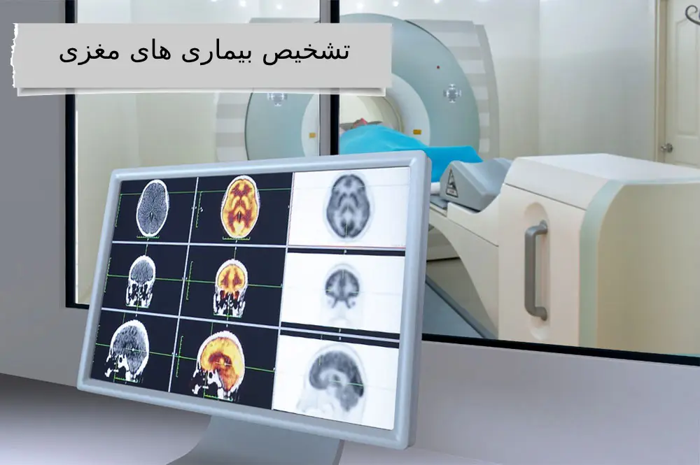 تشخیص بیماری های مغزی در ویستان بیماری های مغزی را در بهترین مرکز اسکن هسته ای در تهران چگونه تشخیص می دهند؟