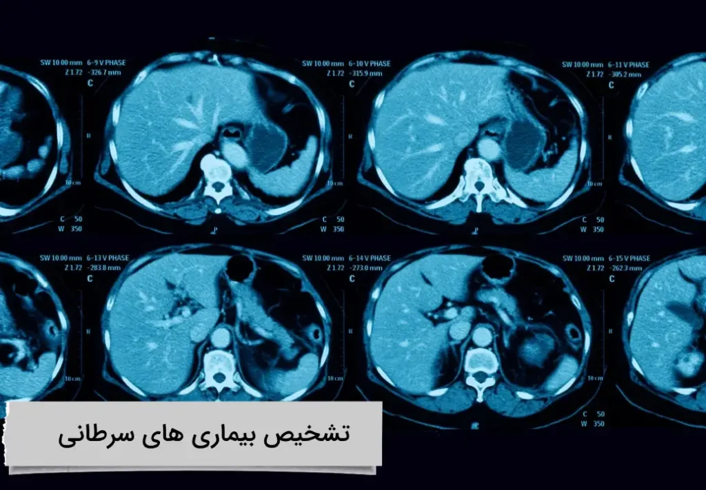 تشخیص بیماری های سرطانی تشخیص بیماری های سرطانی چگونه انجام می شود؟