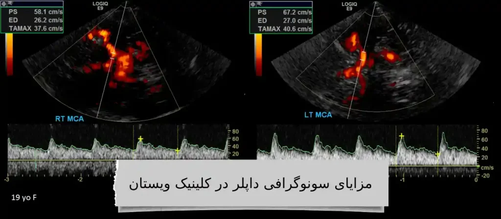 انجام سونوگرافی داپلر در غرب تهران در کلینیک ویستان
