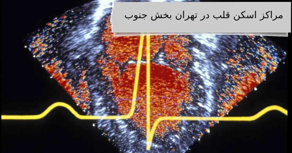 مراکز اسکن قلب در تهران