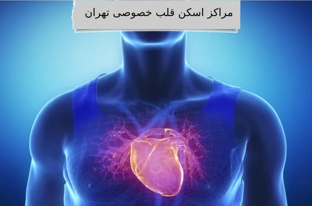 مراکز اسکن قلب در تهران