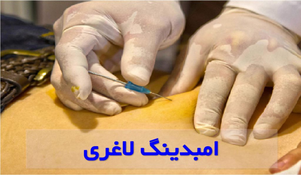 نظرات مردم در مورد امبدینگ | امبدینگ چگونه باعث لاغری میشود؟