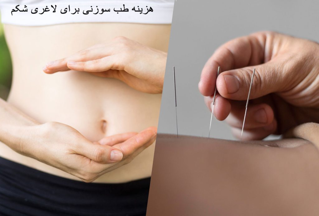 هزینه طب سوزنی برای لاغری شکم در 1403 + تعداد جلسات طب سوزنی